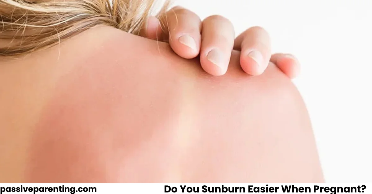 Do You Sunburn Easier When Pregnant? Here’s What You Should Know Do You Sunburn Easier When Pregnant